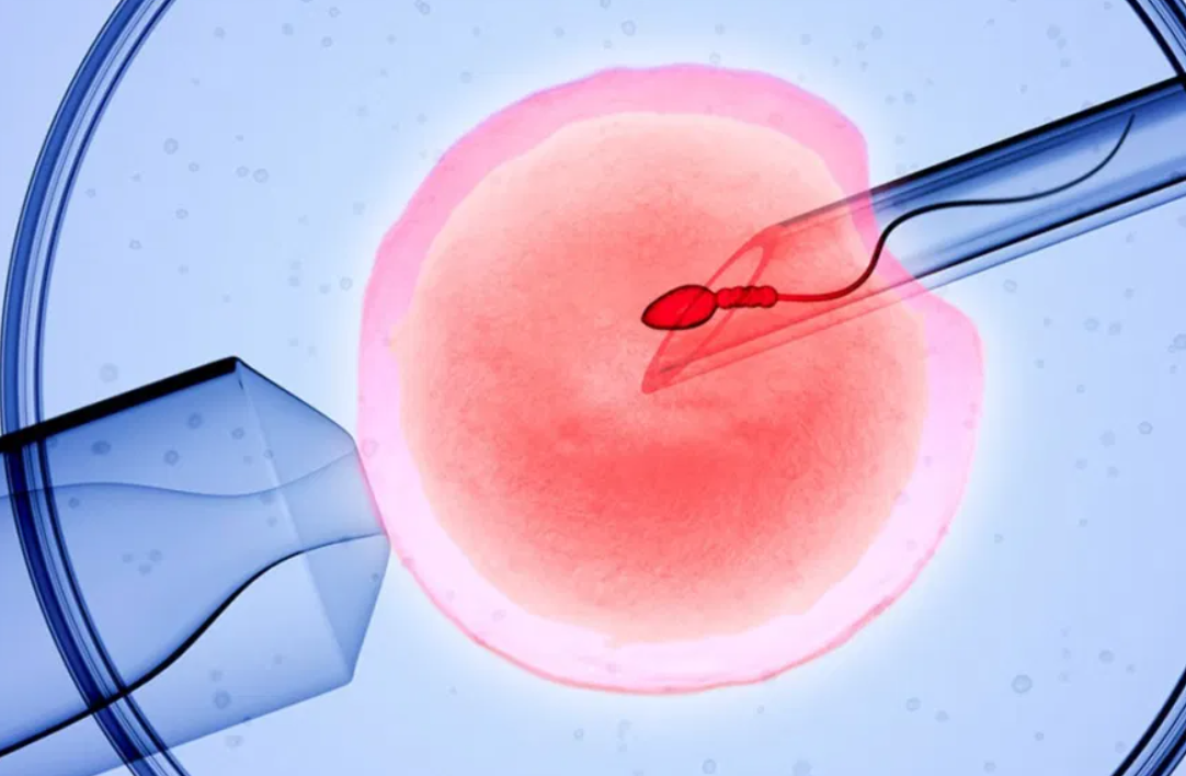IVF in South Africa