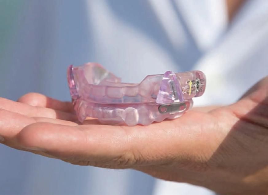 dental appliance for sleep apnea